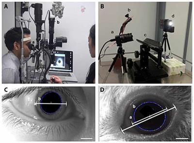 Infrared Video Pupillography Coupled with Smart Phone LED for Measurement of Pupillary Light Reflex